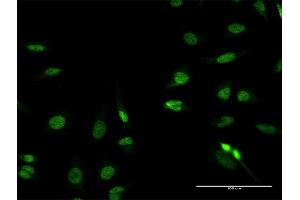 Immunofluorescence of purified MaxPab antibody to RFX2 on HeLa cell. (RFX2 antibody  (AA 1-723))