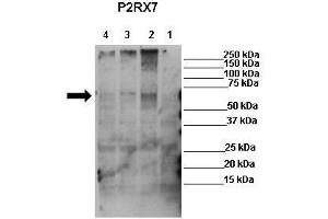 WB Suggested Anti-P2RX7 Antibody  Positive Control: Lane 1: 50ug mock transfected HEK-293Lane 2: 50ug hP2X7 transfected HEK-293Lane 3: 50ug mP2X7 transfected HEK-293Lane 4: 50ug rP2X7 transfected HEK-293 Primary Antibody Dilution :  1:625 Secondary Antibody : Anti-rabbit-HRP Secondry Antibody Dilution :  1:1000 Submitted by: Ronald Sluyter, School of Biological Sciences, University of Wollongong (P2RX7 antibody  (Middle Region))