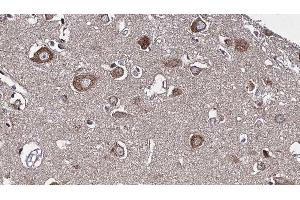 ABIN6277226 at 1/100 staining Human brain cancer tissue by IHC-P. (RIPK2 antibody  (N-Term))