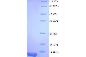 Adrenomedullin (ADM) (AA 45-92) protein (His tag)