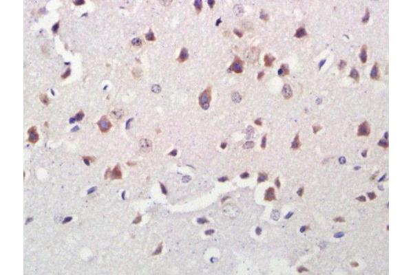 GGACT antibody  (AA 1-50)