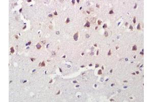 Formalin-fixed and paraffin embedded rat brain labeled with Anti-A2LD1/GGACT Polyclonal Antibody, Unconjugated (ABIN1387486) at 1:300 followed by conjugation to the secondary antibody and DAB staining.