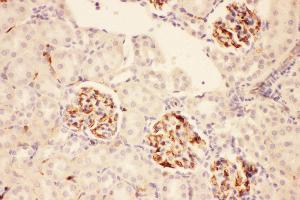 Anti-ACTH Picoband antibody,  IHC(P): Rat Kidney Tissue (POMC antibody  (Middle Region))