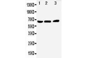 Western Blotting (WB) image for anti-Nuclear Receptor Subfamily 4, Group A, Member 1 (NR4A1) (AA 99-112), (N-Term) antibody (ABIN3044257)