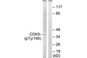 Western blot analysis of extracts from NIH-3T3 cells treated with Forskolin 40nM 30', using CDK9 (Phospho-Thr186) Antibody.
