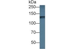 Western blot analysis of Human HeLa cell lysate, using Mouse NIN Antibody (1 µg/ml) and HRP-conjugated Goat Anti-Rabbit antibody (