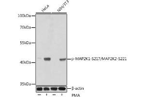 Western blot analysis of extracts of various cell lines, using Phospho-MK1-S217/MK2-S221 antibody (ABIN3019811, ABIN3019812, ABIN3019813, ABIN1681751 and ABIN1681752) at dilution. (MEK1 antibody  (pSer221, Ser217, Ser221))