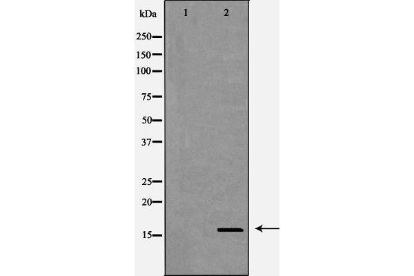 CST8 antibody  (Internal Region)