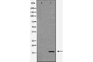 Western blot analysis of HEK293 cell lysate, using CST8 Antibody.