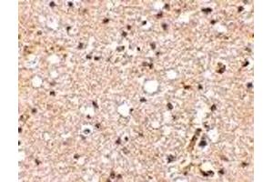 Immunohistochemistry (IHC) image for anti-Glutamate Receptor, Ionotropic, Kainate 1 (GRIK1) (Middle Region) antibody (ABIN1030944) (GRIK1 antibody  (Middle Region))