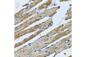 Immunohistochemistry of paraffin-embedded rat heart using ATP5B antibody. (ATP5B antibody  (AA 230-529))