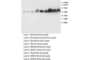 Western blot with Smad 1,2,3,5 Polyclonal Antibody (SMAD1 antibody  (C-Term))