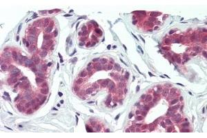 Detection of ITGb6 in Human Breast Tissue using Polyclonal Antibody to Integrin Beta 6 (ITGb6) (ITGB6 antibody  (AA 131-619))