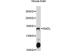Western blot analysis of extracts of mouse brain, using INADL antibody (ABIN5997988) at 1/1000 dilution. (PATJ antibody)