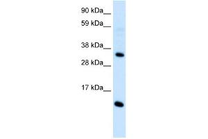 WB Suggested Anti-CCL18  Antibody Titration: 0. (CCL18 antibody  (Middle Region))
