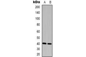 Western blot analysis of FAM203A expression in Hela (A), Colo320 (B) whole cell lysates. (FAM203B antibody)