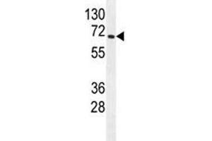 S6K2 antibody western blot analysis in mouse heart tissue lysate. (RPS6KB2 antibody)