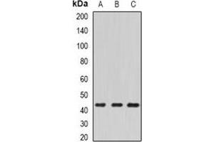 Western blot analysis of ECSIT expression in HepG2 (A), mouse kidney (B), mouse heart (C) whole cell lysates. (ECSIT antibody)