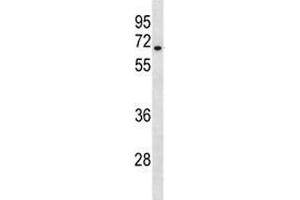 HAS3 antibody western blot analysis in A549 lysate. (HAS3 antibody  (AA 137-164))