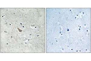 Immunohistochemistry analysis of paraffin-embedded human brain, using Ephrin B1/B2 (Phospho-Tyr329) Antibody. (Ephrin B1/B2 (AA 295-344), (pTyr329) antibody)