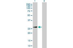 Western Blot analysis of BCAP31 expression in transfected 293T cell line by BCAP31 MaxPab polyclonal antibody. (BCAP31 antibody  (AA 1-246))