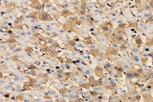 Immunohistochemistry analysis of paraffin-embedded human liver using,MRPL51 (ABIN7074649) at dilution of 1: 4000 (MRPL51 antibody)