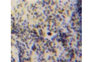 Used in DAB staining on fromalin fixed paraffin-embedded Spleen tissue (GDF3 antibody  (AA 253-366))