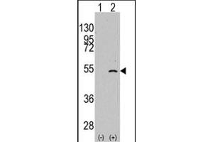 Western blot analysis of ELP3 (arrow) using rabbit polyclonal ELP3 Antibody (C-term) (ABIN387967 and ABIN2844715). (ELP3/KAT9 antibody  (C-Term))