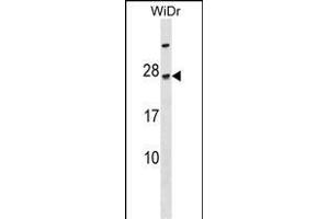 TGIF2LY Antibody (N-term) (ABIN1538862 and ABIN2849859) western blot analysis in WiDr cell line lysates (35 μg/lane). (TGIF2LY antibody  (N-Term))