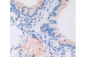 Figure. (TBX3 antibody  (AA 107-220))