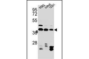 HNRNPC Antibody (C-term) (ABIN654685 and ABIN2844378) western blot analysis in Jurkat,K562, cell line lysates (35 μg/lane). (HNRNPC antibody  (C-Term))