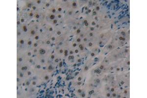 Figure. (BRCC3 antibody  (AA 7-148))