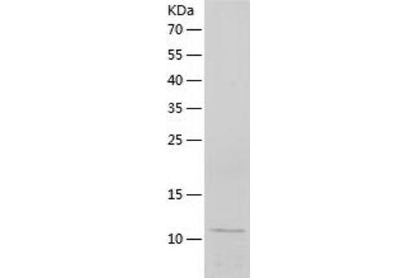 APOC3 Protein (AA 21-99) (His tag)