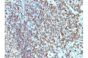 Formalin-fixed, paraffin-embedded human Tonsil stained with HLA-DRB Monoclonal Antibody (SPM288). (HLA-DRB1 antibody)