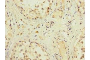 Immunohistochemistry of paraffin-embedded human testis tissue using ABIN7176632 at dilution of 1:100 (ZFPM2 antibody  (AA 982-1151))