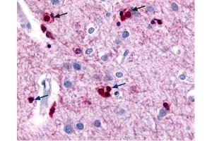 Expression of KCNN2 (SK2) in rat cerebral cortex - Immunohistochemical staining of KCNN2 channels using Anti-KCNN2 (KCa2. (KCNN2 antibody  (C-Term, Intracellular))