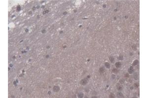 Detection of PDP2 in Rat Cerebrum Tissue using Polyclonal Antibody to Pyruvate Dehydrogenase Phosphatase 2 (PDP2)