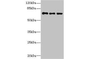 Western blot All lanes: ZNF614 antibody at 6 μg/mL Lane 1: Jurkat whole cell lysate Lane 2: HepG2 whole cell lysate Lane 3: A549 whole cell lysate Secondary Goat polyclonal to rabbit IgG at 1/10000 dilution Predicted band size: 68, 23 kDa Observed band size: 68 kDa (ZNF614 antibody  (AA 1-198))