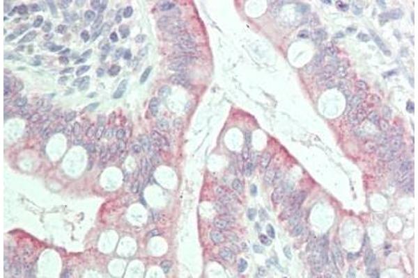 GPR31 antibody  (N-Term)