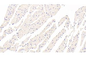 Immunohistochemistry (IHC) image for anti-Tropomodulin 3 (TMOD3) (AA 1-352) antibody (ABIN7436345)
