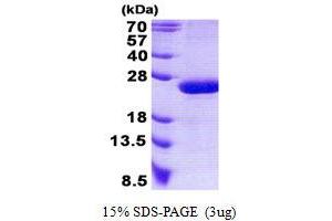 Image no. 1 for RAP2B, Member of RAS Oncogene Family (RAP2B) protein (His tag) (ABIN1098540) (RAP2B Protein (His tag))