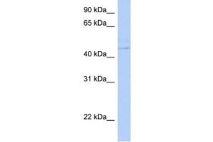 WB Suggested Anti-PSCD4 Antibody Titration: 0. (Cytohesin 4 antibody  (N-Term))