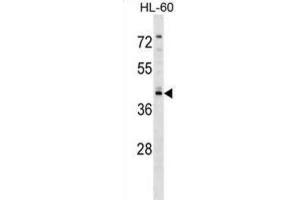Western Blotting (WB) image for anti-Regulator of G-Protein Signaling 11 (RGS11) antibody (ABIN2999155) (RGS11 antibody)