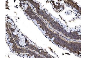 IHC analysis of FOXA2 using anti-FOXA2 antibody (ABIN7600003). (FOXA2 antibody  (AA 139-446))
