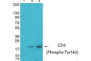 Western blot analysis of extracts from JK cells (Lane 2) and K562 cells (Lane 3), using CD3 zeta (Phospho-Tyr142) antibody. (CD247 antibody  (pTyr142))