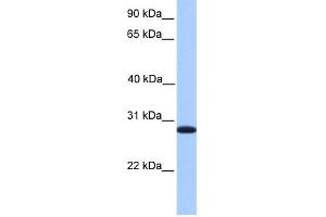 WB Suggested Anti-CDKN3 Antibody Titration: 0. (CDKN3 antibody  (C-Term))