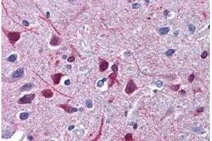 Human Brain, Cortex: Formalin-Fixed, Paraffin-Embedded (FFPE) (Retinoic Acid Receptor beta antibody  (C-Term))