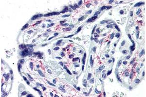 Human Placenta (formalin-fixed, paraffin-embedded) stained with IL1R1 antibody ABIN364253 at 10 ug/ml followed by biotinylated anti-mouse IgG secondary antibody ABIN481714, alkaline phosphatase-streptavidin and chromogen. (IL1R1 antibody  (Extracellular Domain))