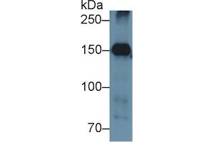 Detection of NPHN in Mouse Kidney lysate using Polyclonal Antibody to Nephrin (NPHN) (Nephrin antibody  (AA 27-234))