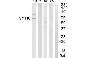 Western blot analysis of extracts from K562 cells, Jurkat cells, 293 cells and HepG2 cells, using SYT16 antibody. (SYT16 antibody  (Internal Region))